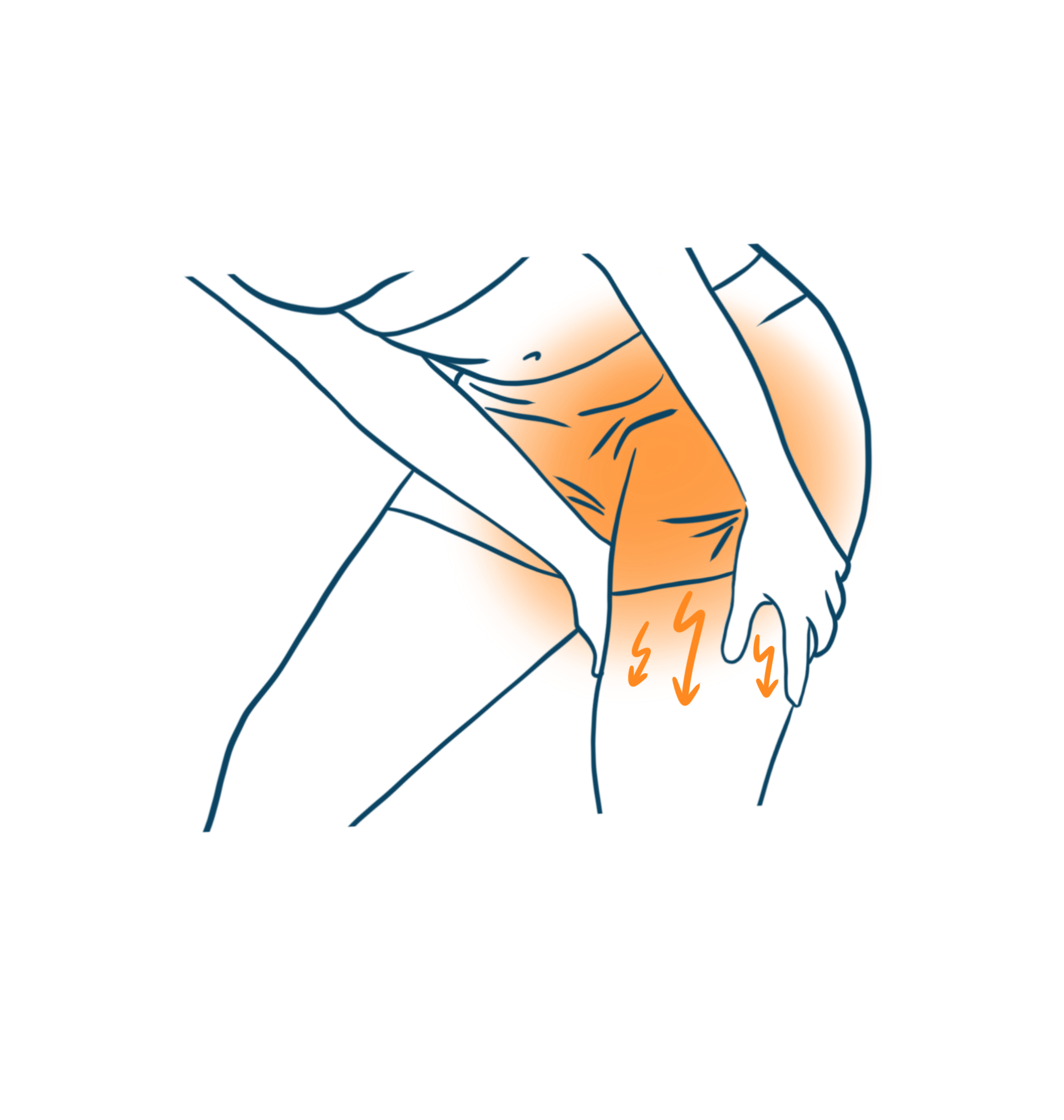 Cruralgie