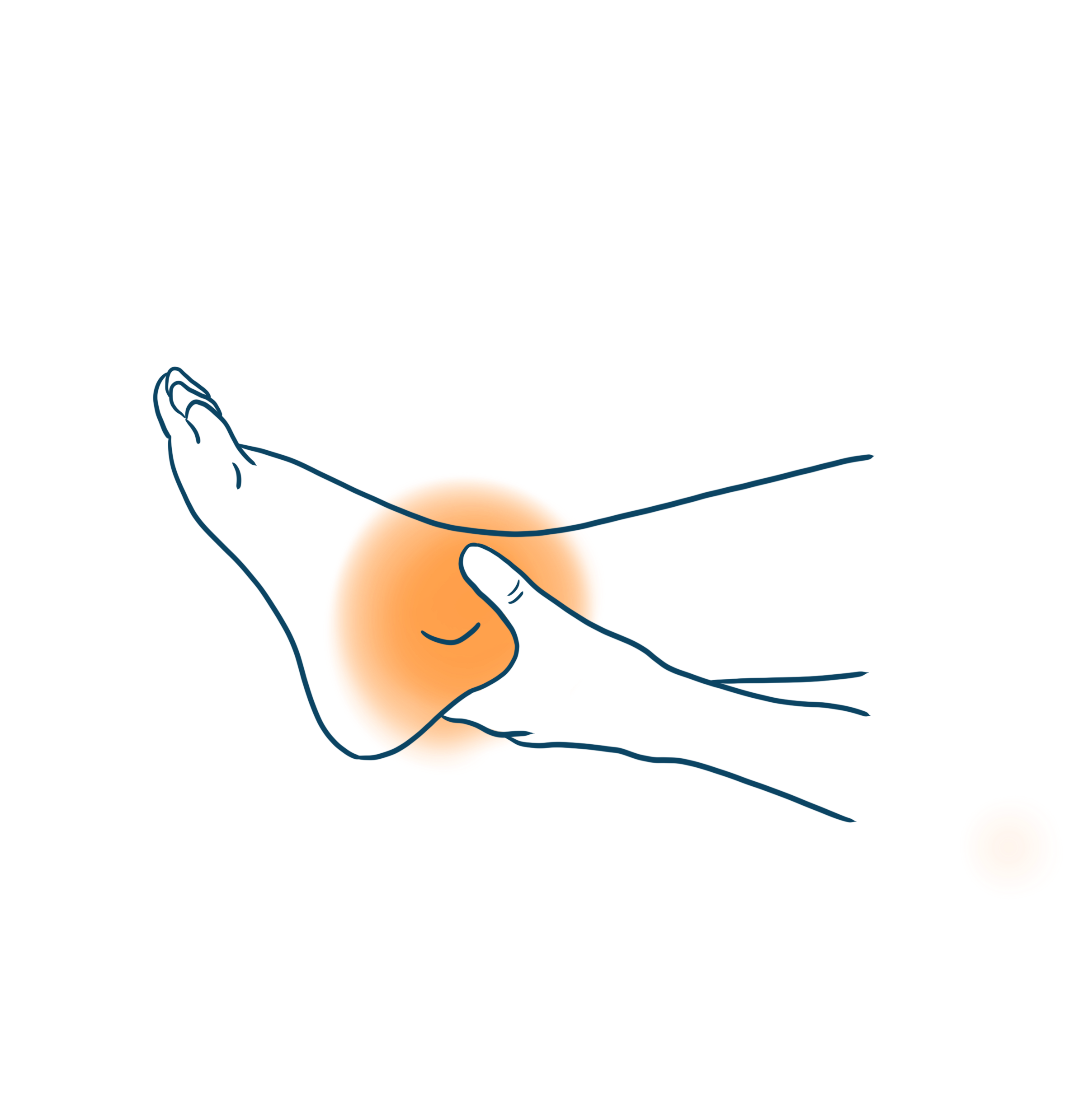 Entorse